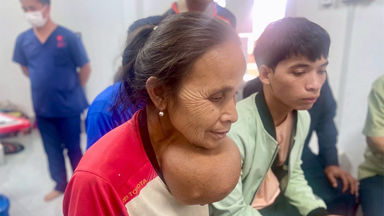 手術前の患者の様子